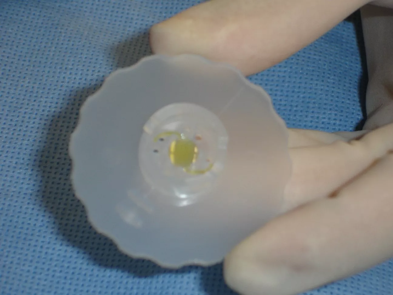 behandeling-cataract-koksijde-8